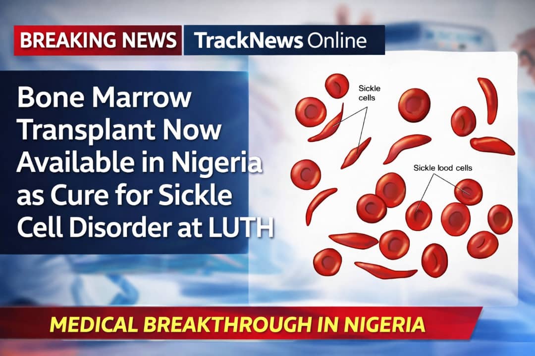 Bone Marrow Transplant Now Available in Nigeria as Cure for Sickle Cell ...